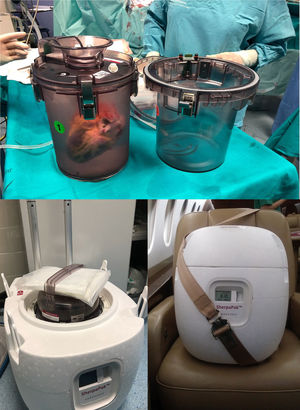 SherpaPakTM CTS de Paragonix. Arriba: dos recipientes estériles donde el corazón se encuentra completamente suspendido y sumergido. Abajo izquierda: colocación del recipiente en la nevera rodeado de los paquetes congelados. Derecha: dispositivo durante el traslado marcando la temperatura del órgano a lo largo de todo el almacenamiento.