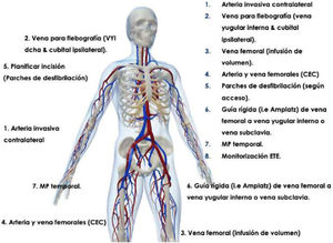 Esquema que muestra la monitorización y preparación intraoperatoria estándar recomendable para la realización de un procedimiento de extracción de electrodos cardíacos mediante vaina láser excimer.