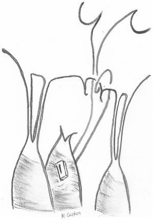 Sutura en ocho («figure-of-eight») para evitar el deslizamiento de la sutura de Gore-tex® durante la medición.
