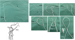 Doble nudo ajustable para anudado de cuerdas de Gore-tex® (Dubai stitch).