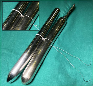 Lazadas múltiples para reemplazo de cuerdas tendinosas («loop techique») con medición mediante tallo de Hegar.
