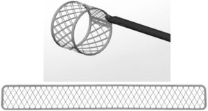 Malla para exposición de músculos papilares mediante retracción de velos mitrales (Superflex Soft Tissue Retractor, Fehling Instruments, Kennesaw, GA, EE. UU.).
