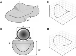 Estructura y diámetros del anillo mitral. (A) Conformación en silla de montar. (C) Conformación tridimensional normal. (D) Conformación tridimensional en disfunción tipo I. a: elevación del anillo anterior. AP: distancia antero-posterior; IC: distancia intercomisural; IT: distancia intertrigonal; p: elevación del anillo posterior. Fuente: modificado de Oliveira et al.39.