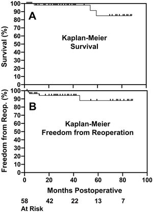 Kaplan–Meier survival (Panel A) and freedom from reoperation (Panel B) after predominant tri-leaflet aortic valve repair with geometric ring annuloplasty.42 Outcomes are consistent with other types of valve repair, except that a wider spectrum of AI pathologies were treated in this series.