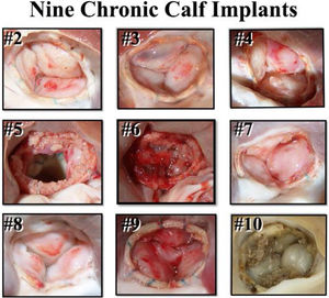 Post-mortem appearance of 9 calf aortic valves after 2-months of ring implants. All animals survived, and all valves were competent. The leaflet excrescences were determined to be post-mortem clot in animals who were in cold storage for a period before autopsy.25