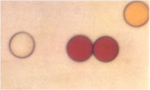 Microeferas × 1.100 de los diferentes colores utilizados, Dye-Track™ Triton Technology®.