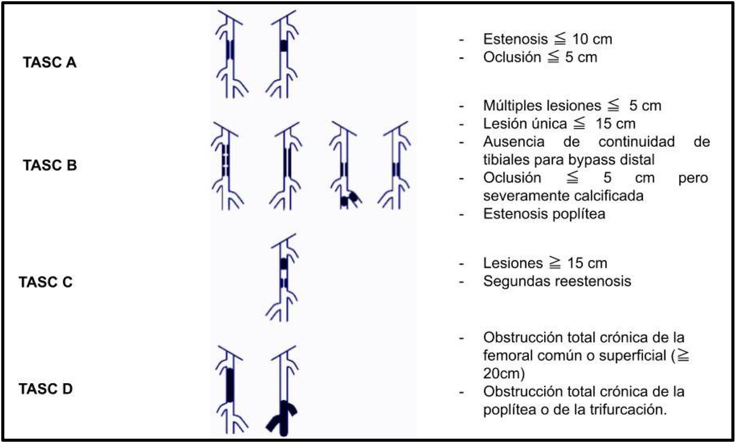 Técnicas endovasculares de revascularización de miembros inferiores ...