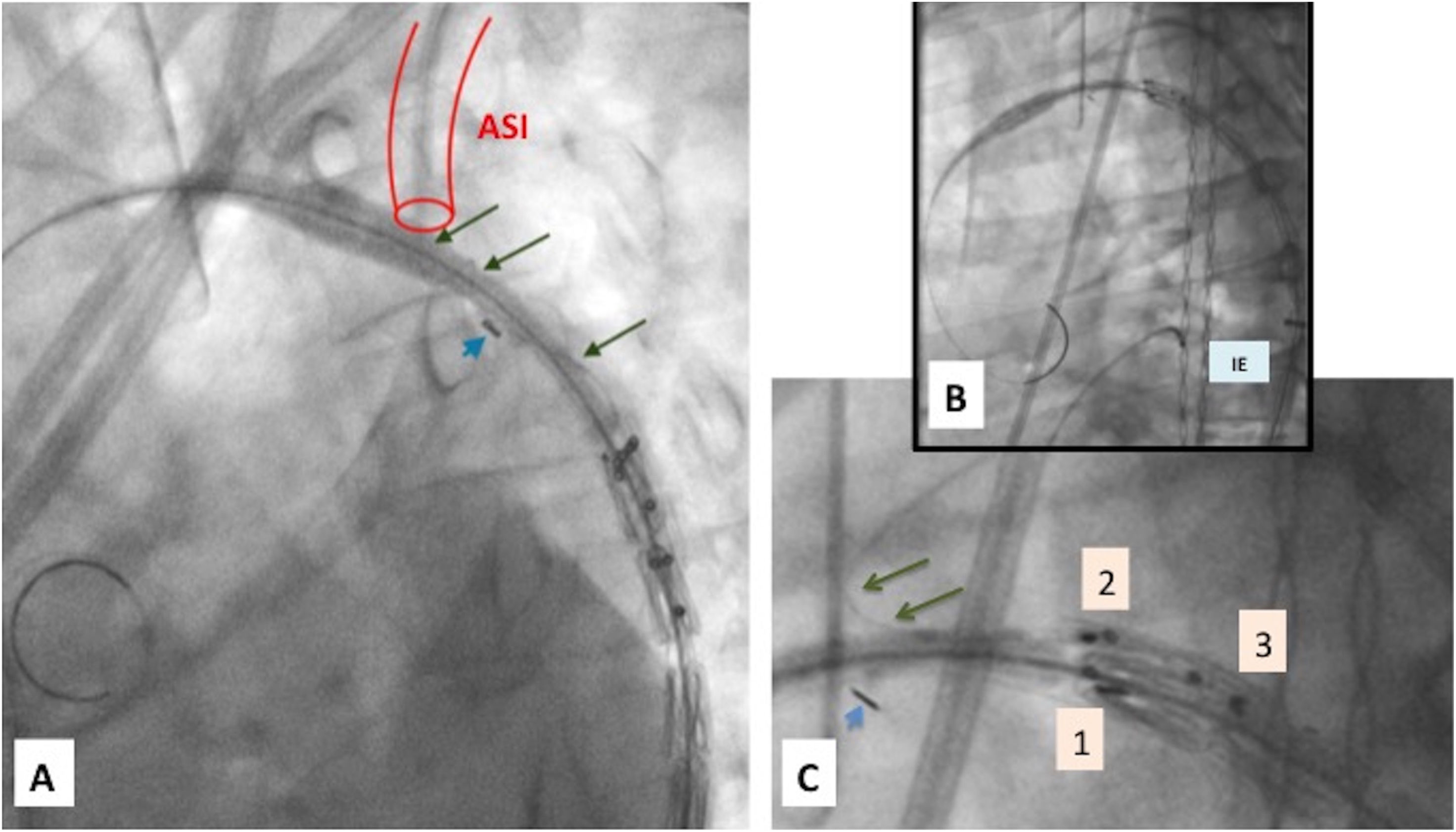 fig0010