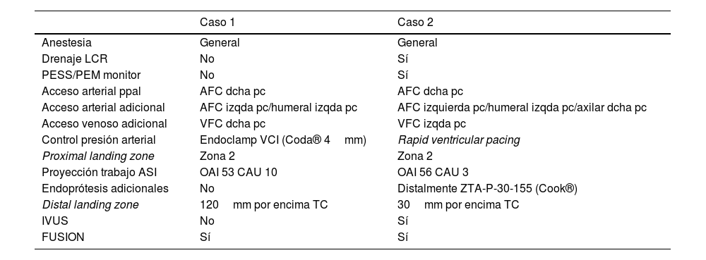 Tablas