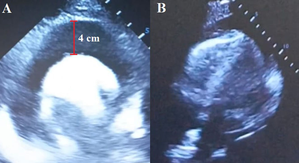 fig0010