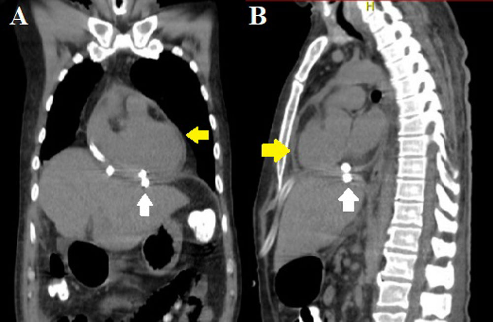 fig0030