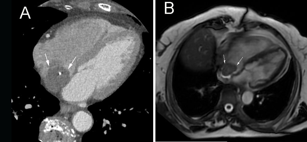 fig0010