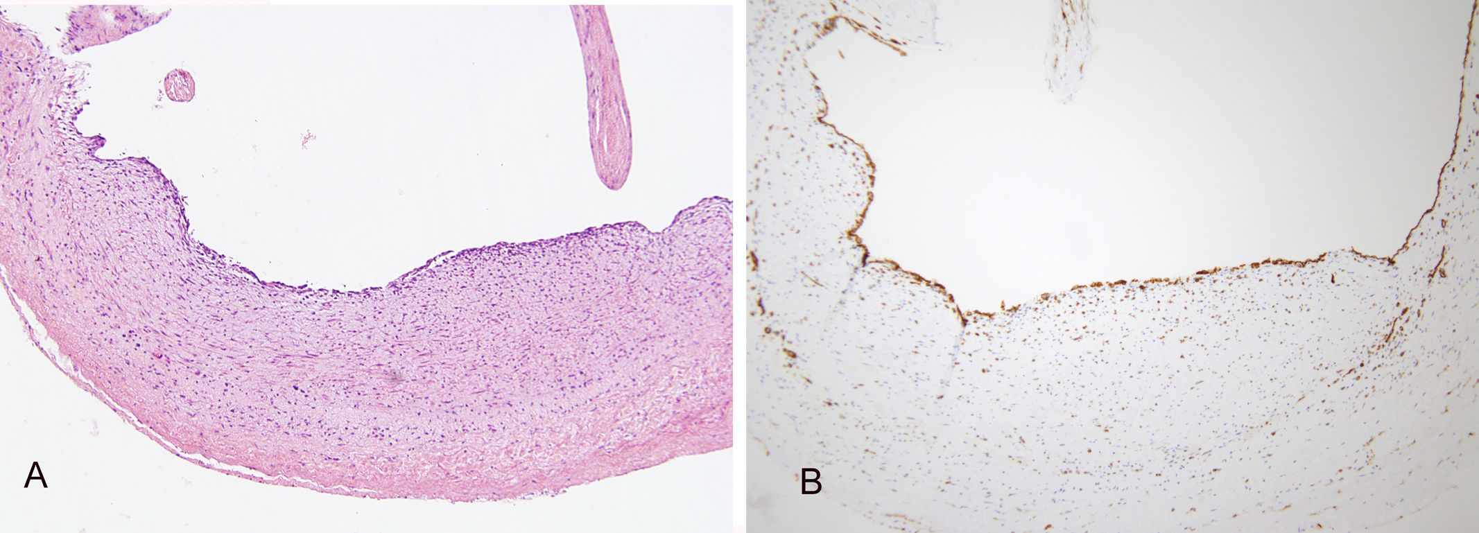 fig0025