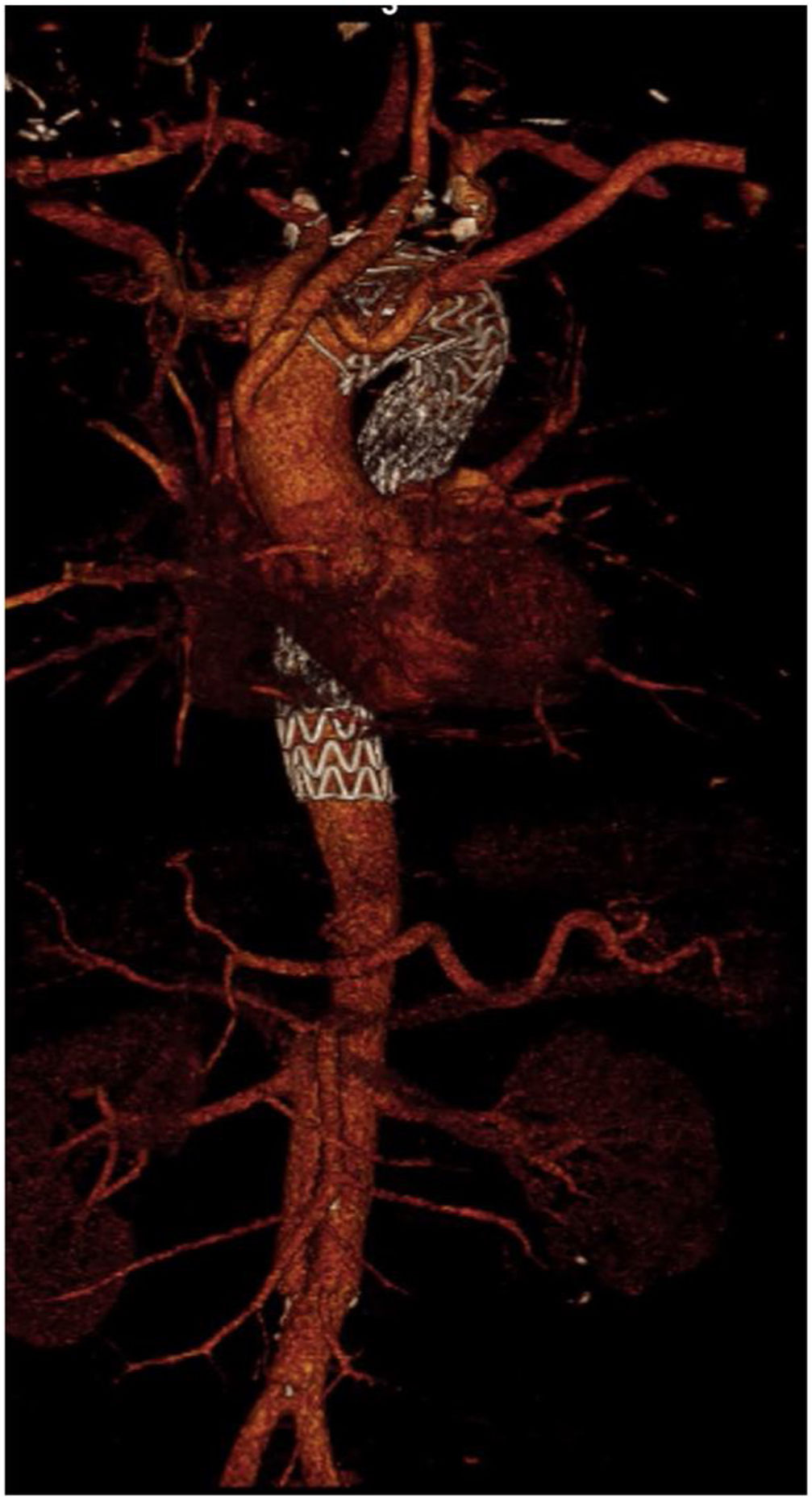 fig0005