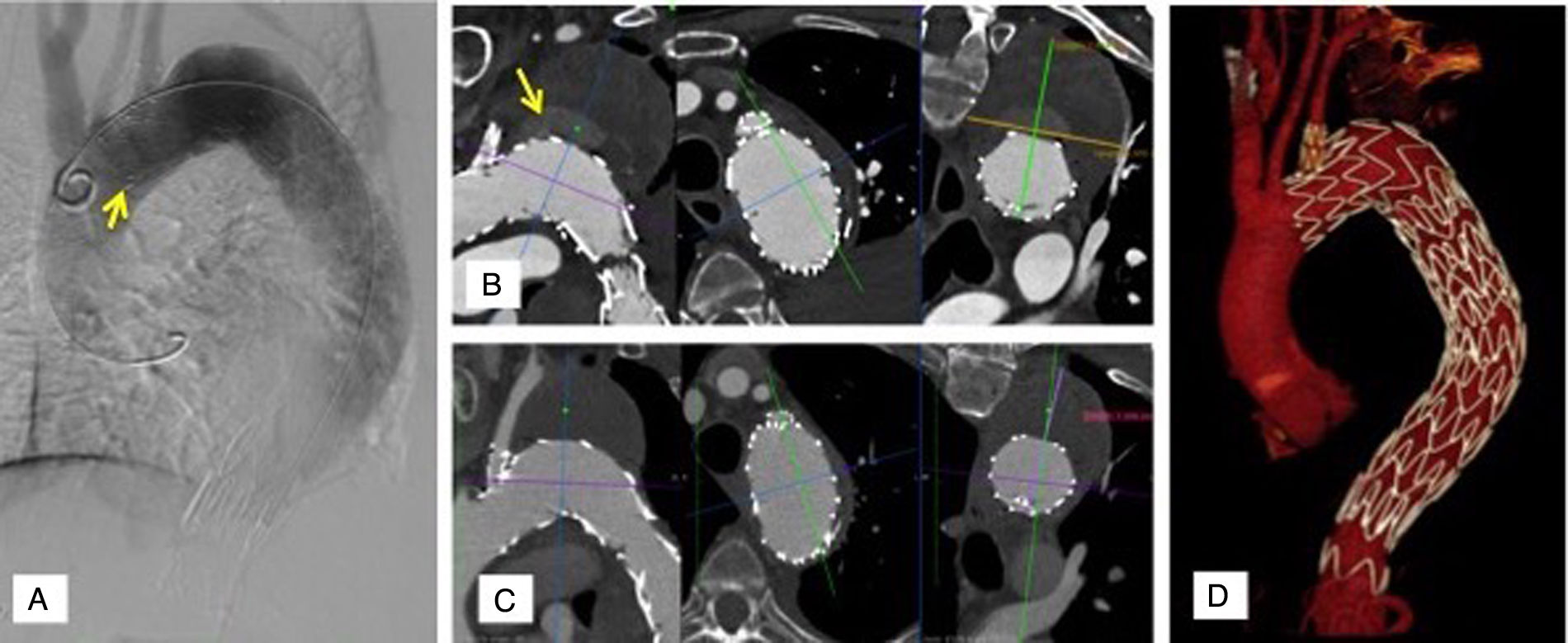 fig0030
