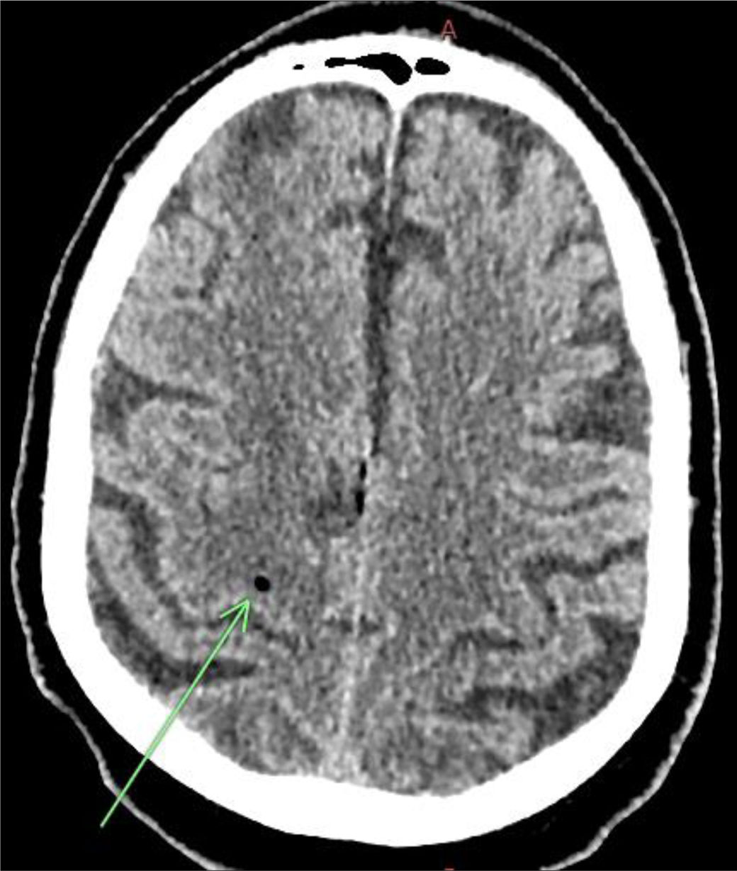 fig0005