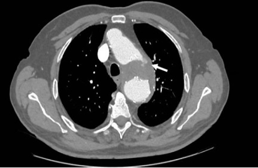 fig0015