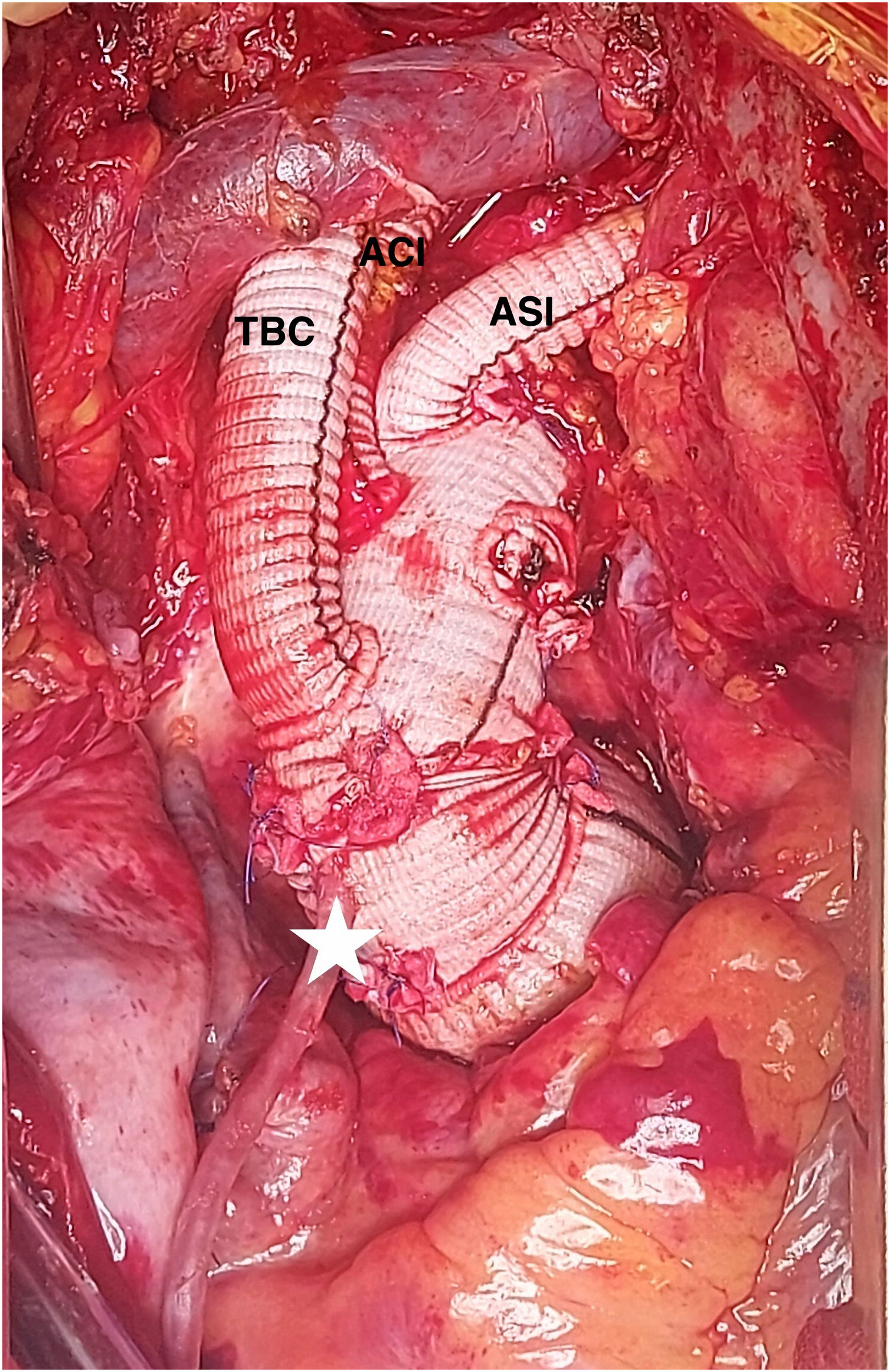 fig0025