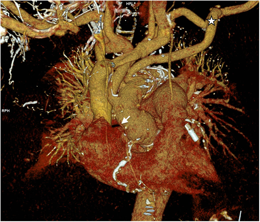 fig0035