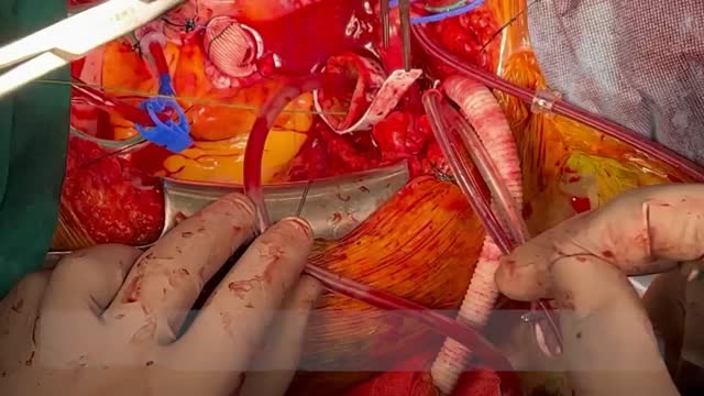 https://ars.els-cdn.com/content/image/1-s2.0-S113400962400024X-mmc2.mp4