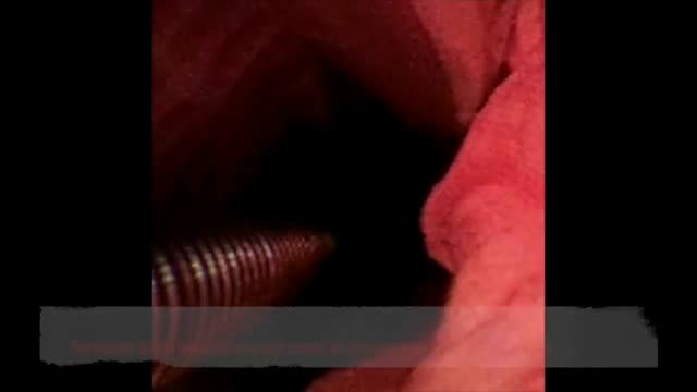 https://ars.els-cdn.com/content/image/1-s2.0-S113400962400024X-mmc3.mp4
