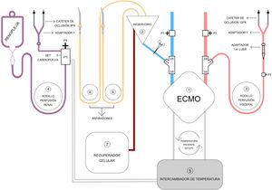 Componentes del circuito de perfusión híbrido. Circuito oxigenador de membrana extracorpórea (ECMO) de corta duración Maquet Cardiohelp® (1). En azul, la línea venosa de drenaje, con monitorización de la presión (P1), y con una conexión 3/8-3/8-1/4 de derivación al reservorio (2) para introducción de volumen. En rojo, la línea arterial de retorno, con monitorización de la presión sistémica (P2), y con una conexión 3/8-3/8-1/4 que sirve para derivar sangre oxigenada al rodillo para la perfusión visceral (3), cuya presión también está monitorizada (P3). El rodillo de perfusión renal o de renoplejía (4) es independiente; utiliza un sistema de distribución de cardioplejía también con monitorización de la presión (P4). El intercambiador de temperatura (5) sirve para el circuito ECMO y para el circuito de renoplejía. Adicionalmente, se usan rodillos de aspiración del campo quirúrgico (6) y recuperador celular (7) conectados al reservorio.
