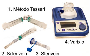 Métodos para la generación de espuma más usados en la actualidad: 1. Método Tessari; 2. Sclerivein y 3. Sterivein; 4. Varixio.