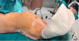 Posición del paciente.