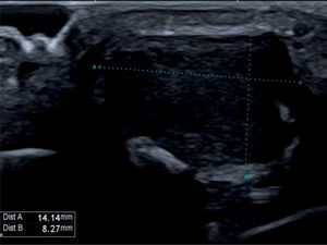 Figura 2