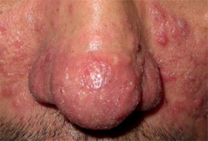 Figura 2