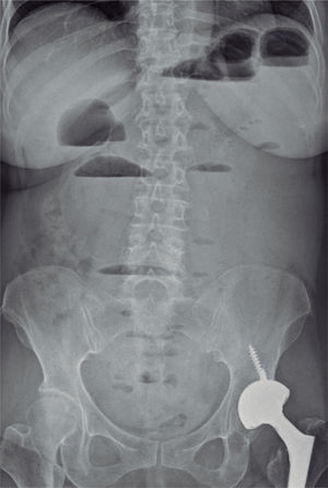 Figura 1