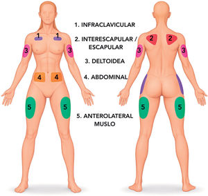 Figura 2