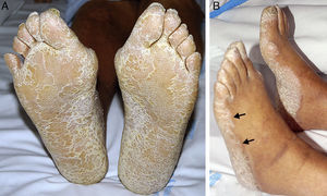 Detalle de los pies.