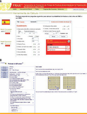 En la figura se muestran dos de los más recientes modelos de cálculo del riesgo absoluto de fractura o del riesgo porcentual de sufrir fractura en los siguientes 10 años. A. En el modelo FRAX®, desarrollado bajo el auspicio de la Organización Mundial de la Salud (disponible en: http://www.shef.ac.uk/FRAX/tooLSRjsp?locationValue=4), la densidad mineral ósea no es necesaria, aunque puede incluirse su información si está disponible. El resto de datos necesarios, como el peso, la talla, el sexo o la edad, así como algunos antecedentes personales y familiares relevantes, se pueden obtener fácilmente. Algunos autores han sugerido que, en nuestro medio y a pesar de estar ajustado para la tasa de fracturas de la población española, el FRAX® podría infraestimar hasta en un 50% el riesgo real. B. El modelo □Fracture™, desarrollado en el Reino Unido y aún pendiente de publicar ajustado para población española (disponible en: http://www.clinrisk.co.uk/qfracture/index.php), posee el atractivo de no emplear la medida de la masa ósea y usar un mayor número de antecedentes y enfermedades crónicas concomitantes, y para nosotros, como diabetólogos o endocrinólogos, incluir específicamente el antecedente de diabetes o de enfermedades endocrinas como el síndrome de Cushing o el hipertiroidismo