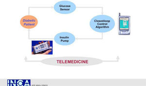 Project Goal: To build a mobile intelligent Personal Smart Assistant (SA) for continuous monitoring glucose and subcutaneous insulin infusion integrated into a Telemedicine Management Service.