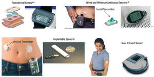 Glucose sensor. aTamada et al. JAMA. 1999;282:1839-44. bGarg and Jovanovic54. cFeldman et al. Diabetes Technol Ther. 2003;5:769-79. dBoland et al. Diabetes Care. 2001;24:1858-62. eGarg et al. Diabetes Care. 2004;27:734-8. fMonfre et al. European Association for the Study of Diabetes, 2004.
