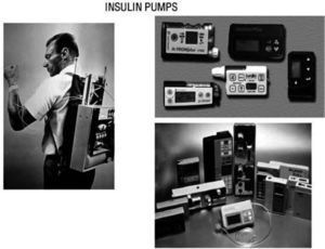 In 1974 Gérard Slama designed the first prototype for an intravenous insulin pump (left). First CSII system was used by John Pickup and Harry Keen, in 1978. Later on, pumps have been reduced in size and developed programs for multiple basal rates of insulin infusion and premeal bolus (right).