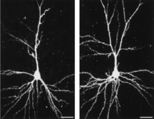 Dendritic morphology of pyramidal neurons in layer III of the somatosensory cortex in rat housed in (left) standard and (right) enriched environments. Bar=25μm. The enrichment significantly increases dendritic branching as well as the number of dendritic spines (cf. Johansson & Belichenko, 2001).
