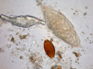 Schistosoma haematobium. Trichuris trichiura.