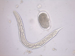 Strongyloides stercoralis. Uncinaria.