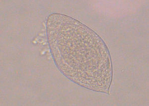 Huevo de Schistosoma haematobium con su típico espolón terminal.