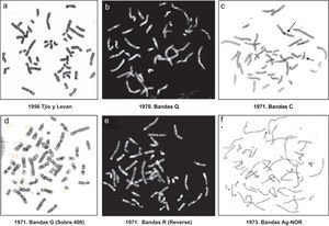 Tipos de tinciones de los cromosomas.