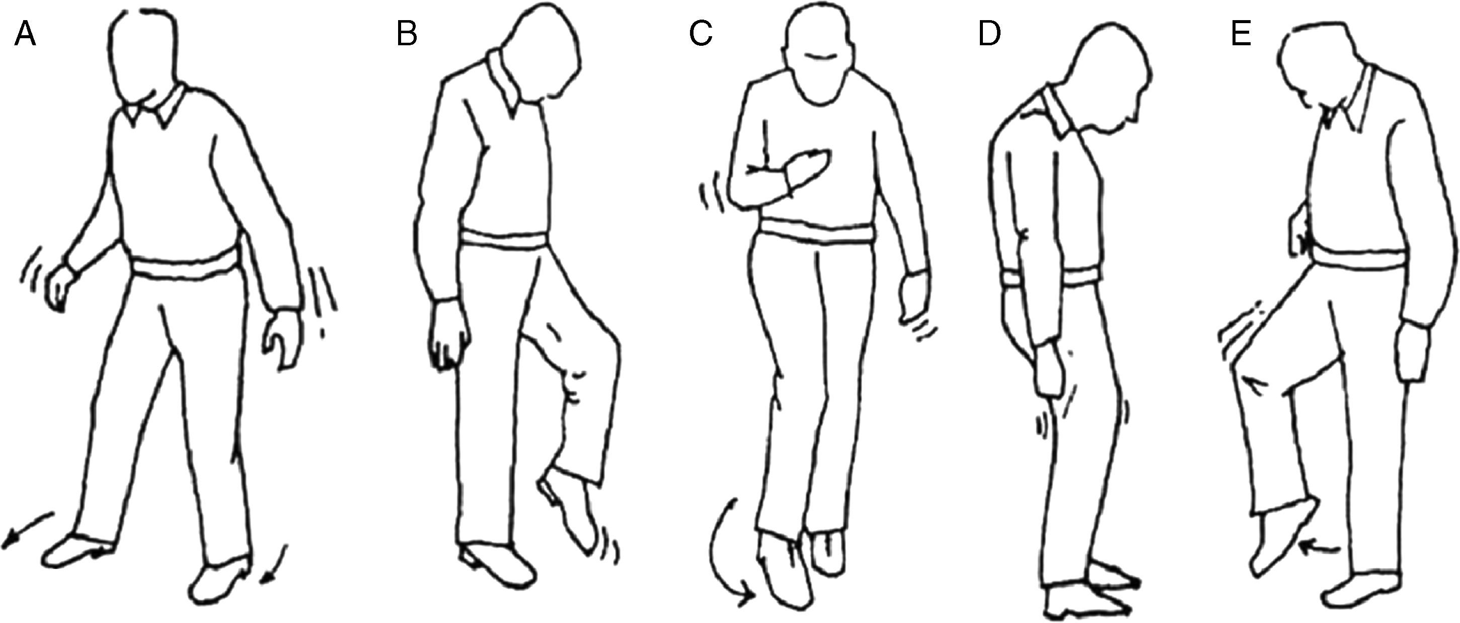 Exploración neurológica y atención primaria. Bloque I: pares craneales ...