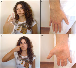 Exploración de la coordinación y cerebelo. A) Prueba dedo-nariz-dedo. B) Prueba índice-nariz. C y D) Prueba de movimientos alternantes rápidos.