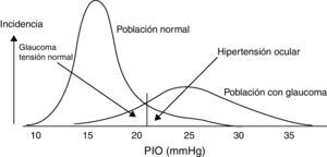 Ejemplo ilustrativo de la distribución de la PIO para la población normal y glaucomatosa. Tomada de González de la Rosa et al.5.