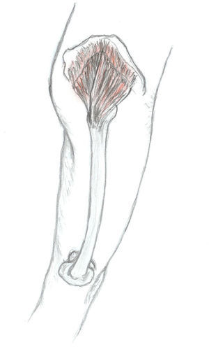 Anatomía del músculo glúteo medio.