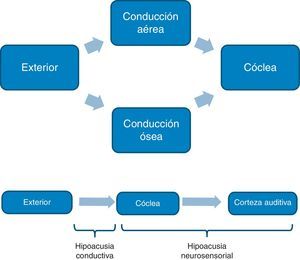 Arriba se muestra cómo el sonido es conducido a la cóclea mediante la vía ósea o aérea. Abajo se muestra la clasificación de la hipoacusia según la localización de la lesión en la vía auditiva.