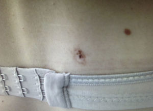 Localización de la lesión.