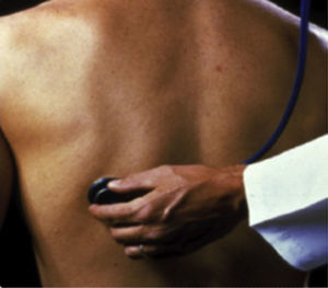 Estertores crepitantes tipo velcro.