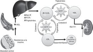 Fisiopatología de la dislipidemia diabética. AGL: ácidos grasos libres; Apo: apolipoproteína; CETP: proteína transferidora de ésteres de colesterol; HDL: lipoproteínas alta densidad; LDL: lipoproteína de baja densidad; VLDL, lipoproteínas de muy baja densidad. Modificada de Pedro-Botet et al.13.